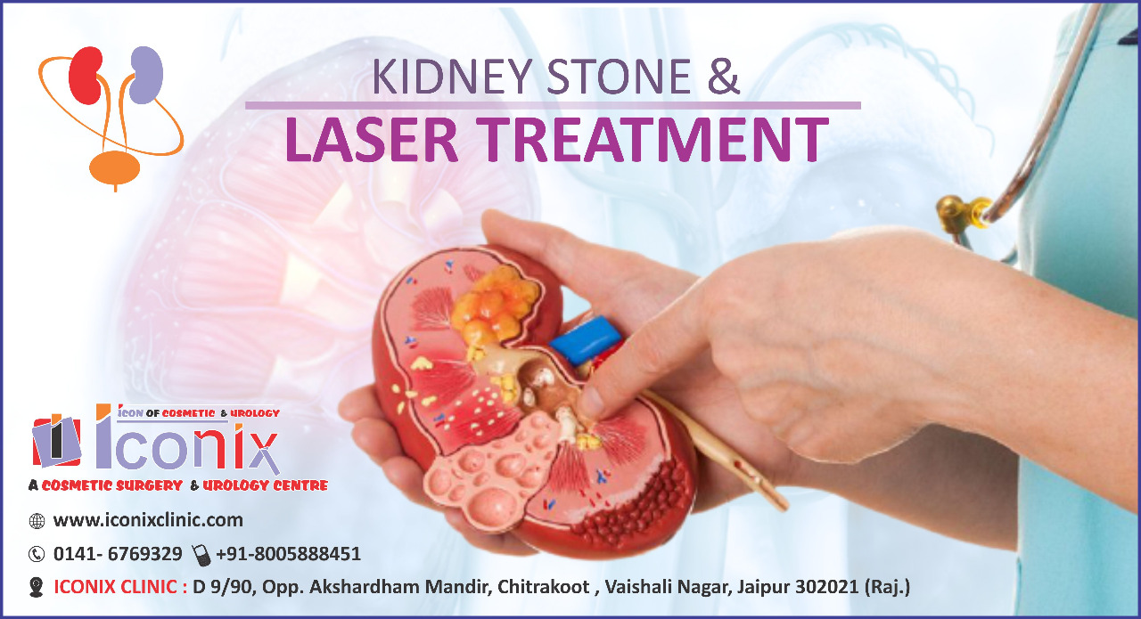 Laser Stone Treatment near me